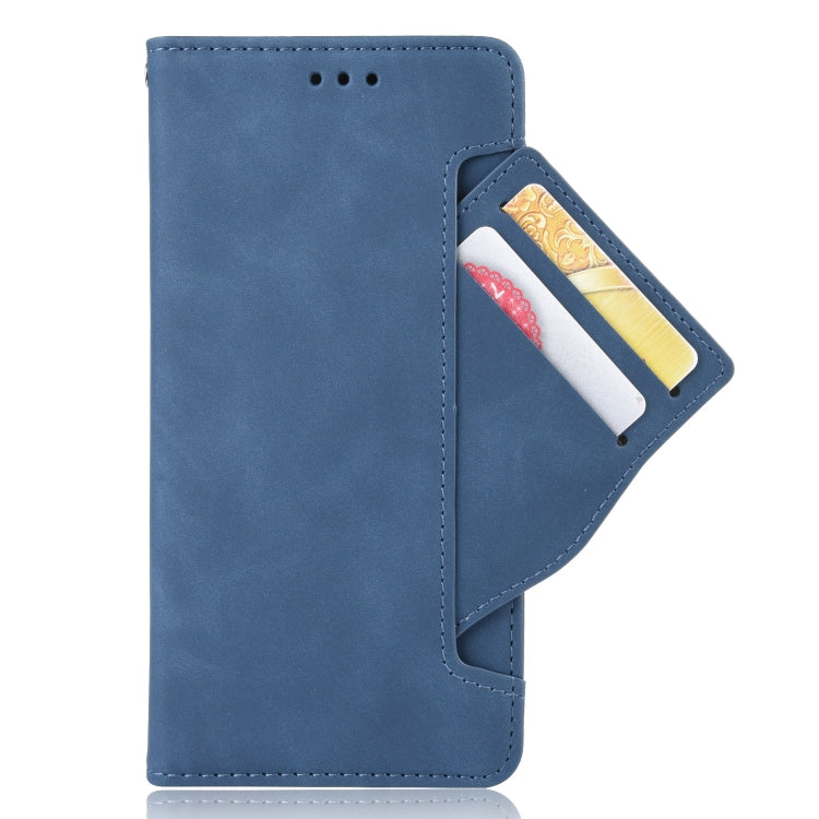 For Xiaomi Redmi 10 Skin Feel Calf Pattern Horizontal Flip Leather Case with Holder & Card Slots & Photo Frame(Blue) - Xiaomi Cases by buy2fix | Online Shopping UK | buy2fix